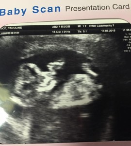 12 week baby scan